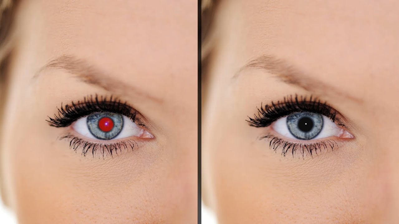 Red and normal eyes of a girl, close up view